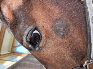 Sarkoid Backe mit Aciclovir und Auge noch unbehandelt