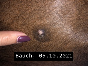 Sarkoid Bauch-2021-10-05.jpeg